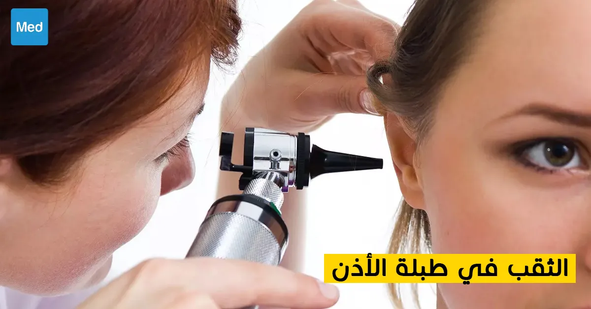 الثقب في طبلة الأذن 